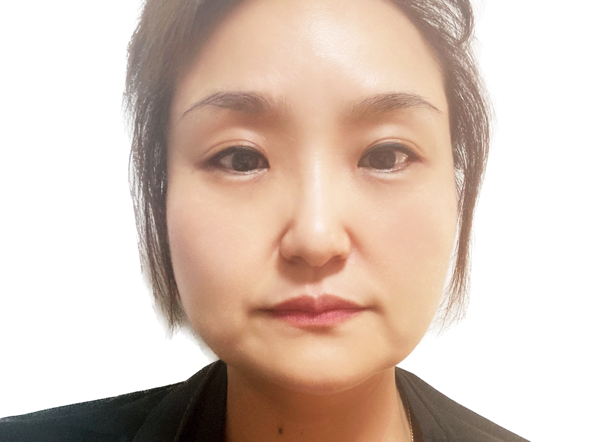 돌기실 시술 전