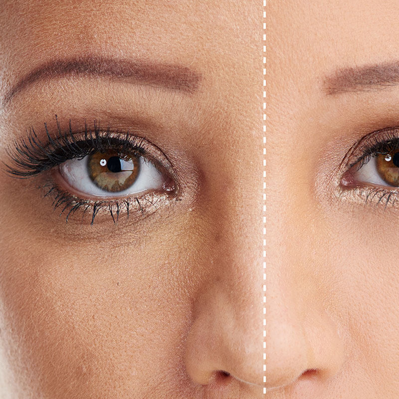 비만체형관리 1