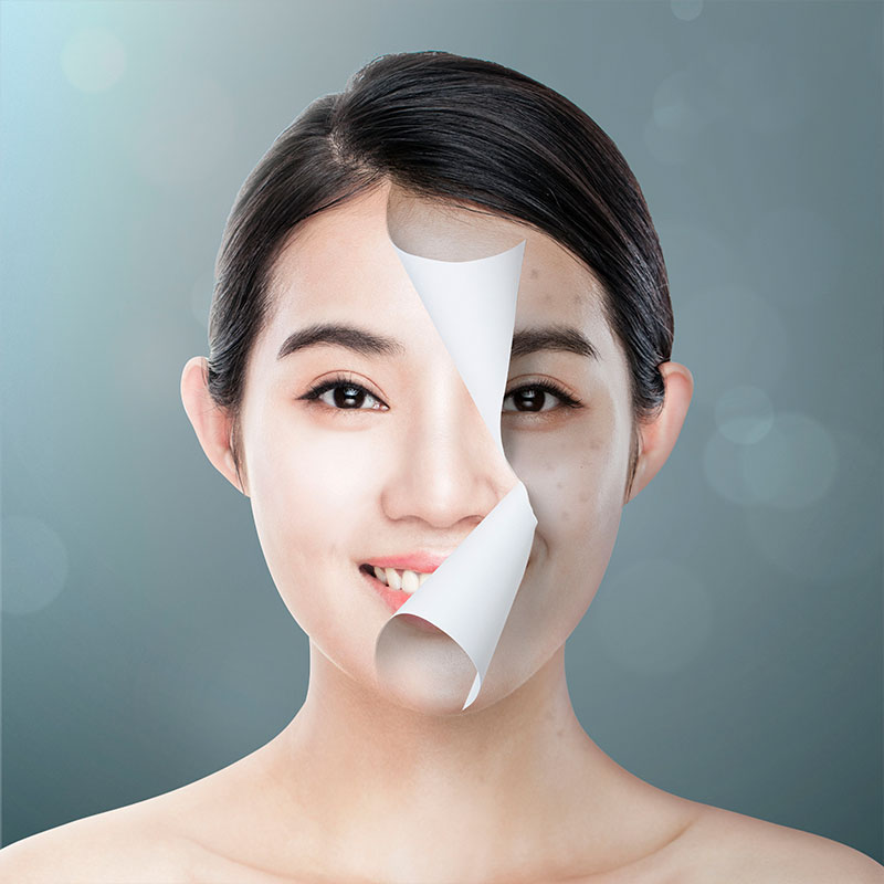 비만체형관리 2